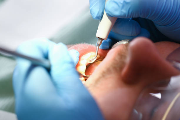 Best Emergency Dental Care for Trauma or Injury in Port Gibson, MS