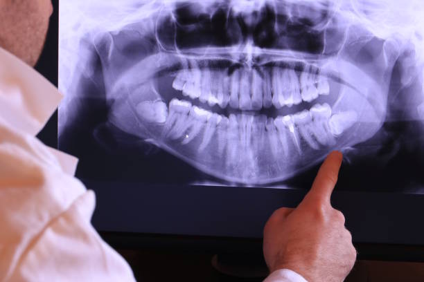 Best Emergency Dental Surgery in Port Gibson, MS