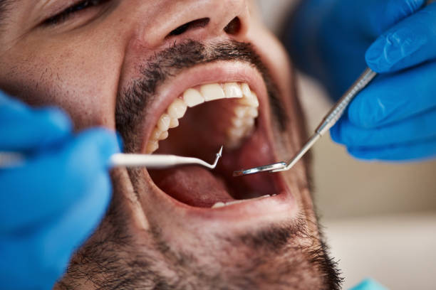 Best Emergency Treatment for Toothache in Port Gibson, MS